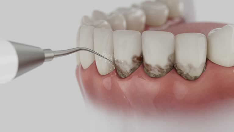 Reliable Dental Crowns And Bridges contractor in McCone County County, MT by Dentist Open Now